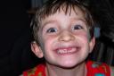 Two Front Teeth